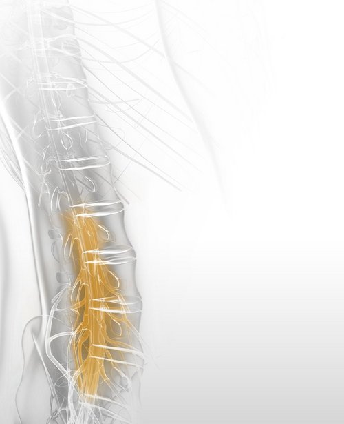 Spine graphic showing yellow highlighted treatment area