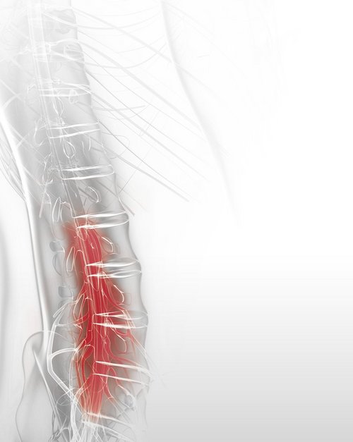 Spine graphic showing red highlighted treatment area