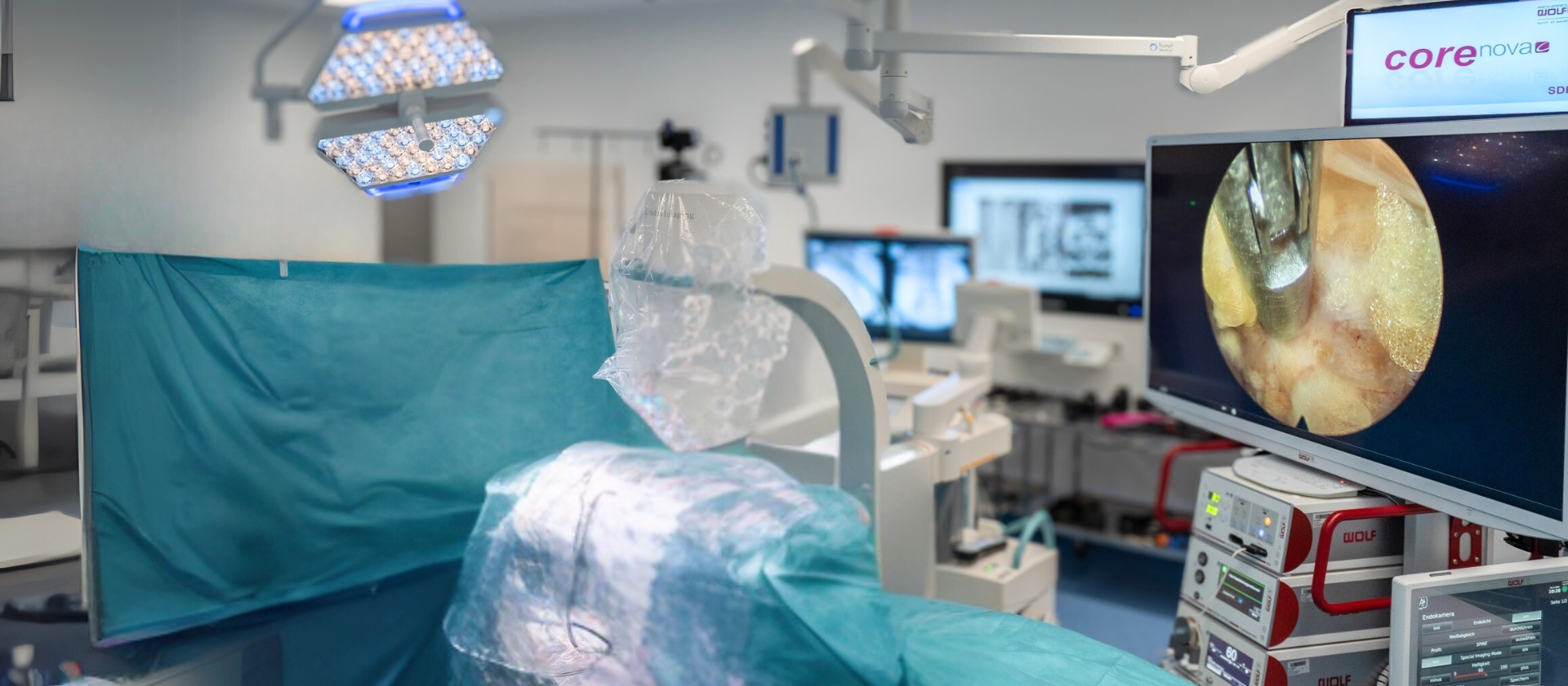 riwospine-endoscopic-spine-surgery-operating-room-setup.png Modern OR setup with RIWOspine endoscopic spine surgery system and 4K monitor