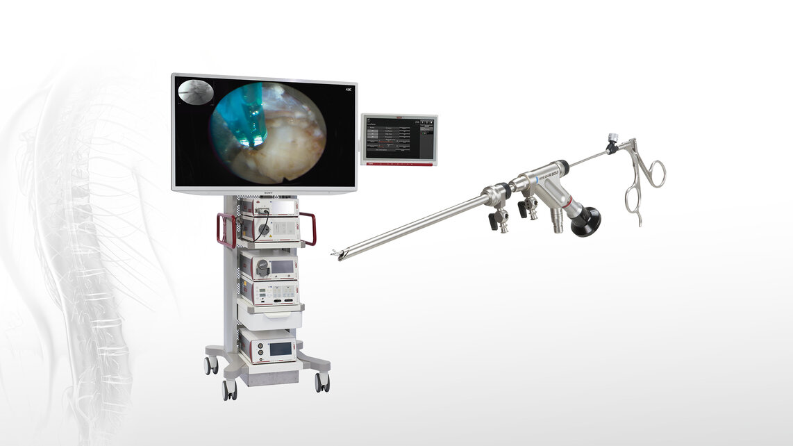 L'Orl chirurgie endoscopique rigide complète de la colonne vertébrale du  système de caméra de l'endoscope - Chine Ensemble complet de la chirurgie  ORL, Ent Endoscope caméra