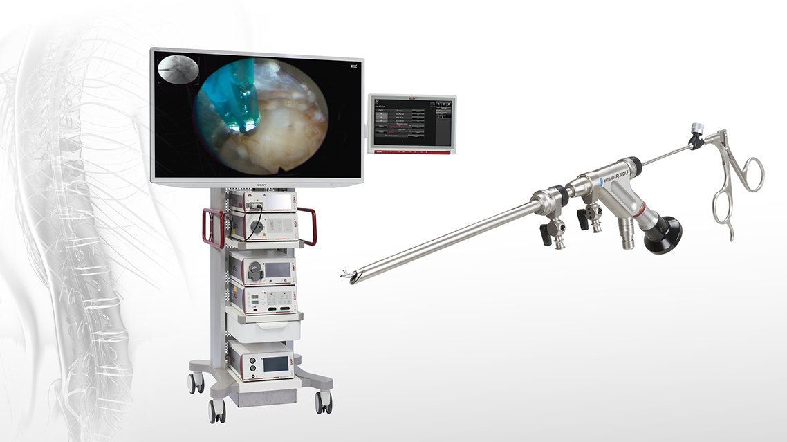 riwospine-endoscopic-equipment-unit.png RIWOspine equipment unit with endoscopic tower, monitor and spine surgery instruments