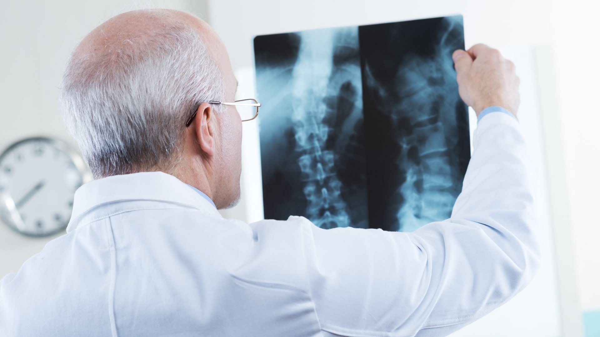 spinal-fusion-xray-analysis-riwospine.png A surgeon from behind viewing and holding X-ray images of a spine and a cervical spine.