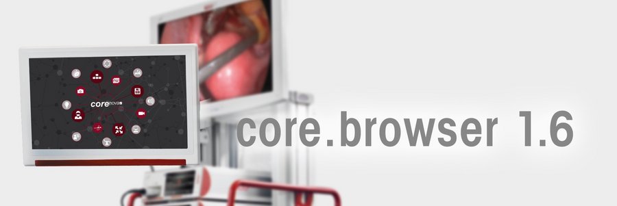 riwospine-core-browser-1-6-digital-or-software.png RIWOspine core.browser 1.6 interface – digital OR control and image management software